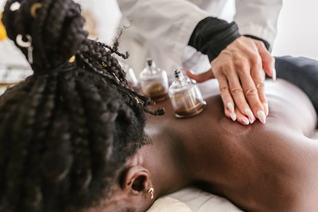 Cupping therapy appointment