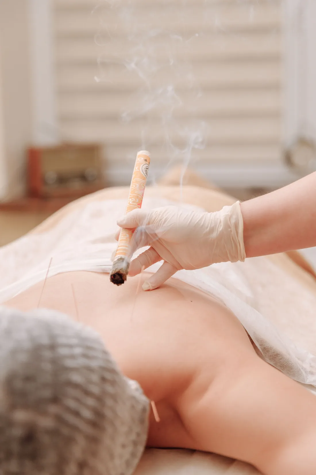Moxibustion treatment